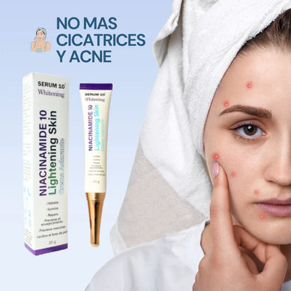 Aclaramiento de Pigmento 2x1 - S10™
